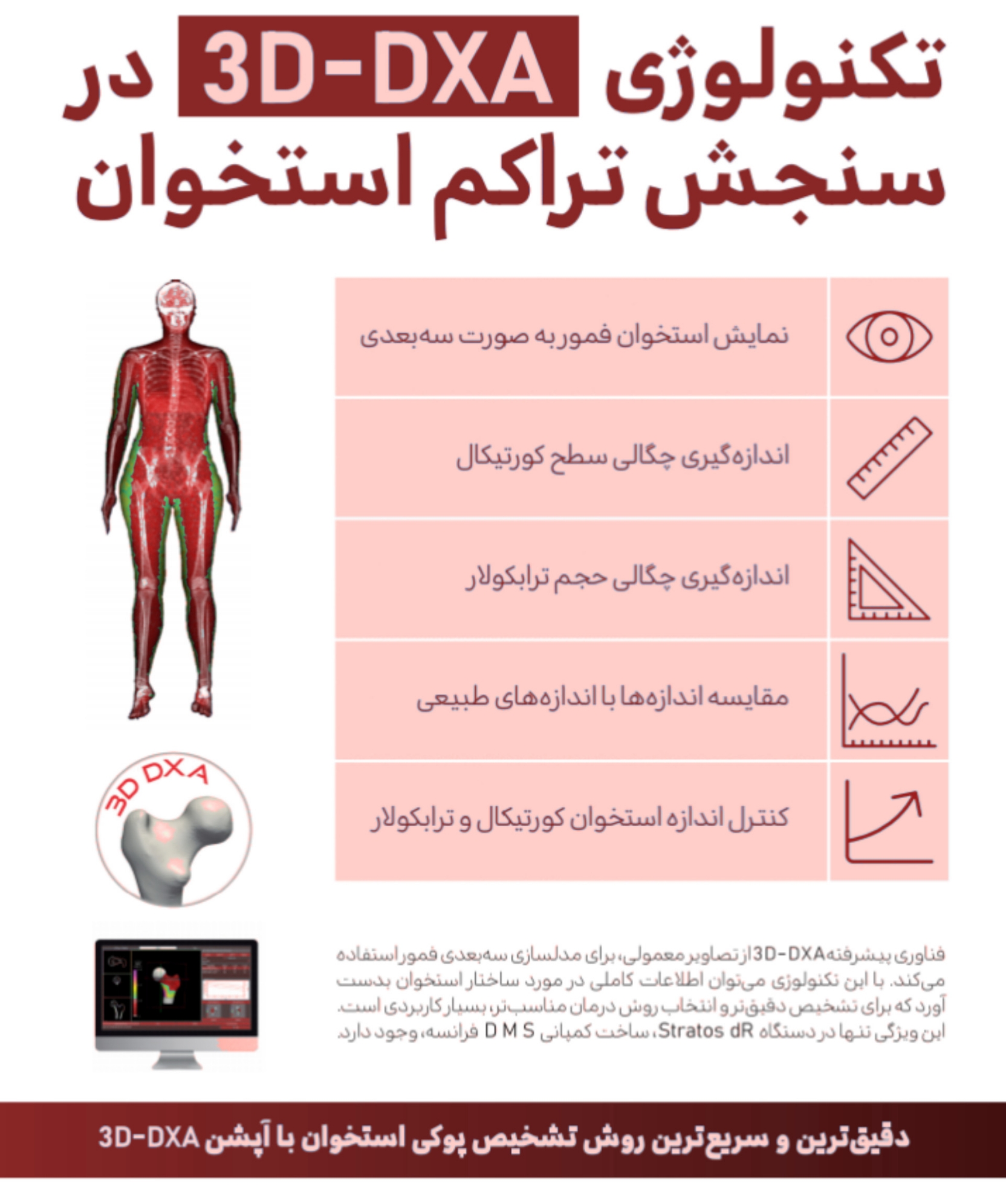 سنجش تراکم استخوان 